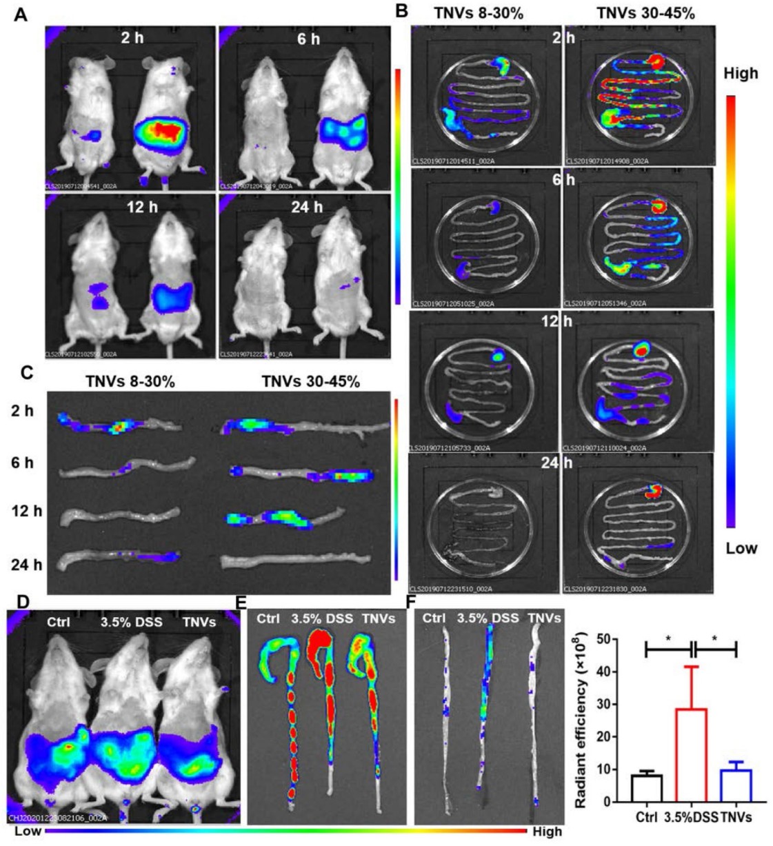 Distribution of DiR-labeled turmeric-derived nanovesicles (TNVs) in mouse GI tract and colon, with imaging in healthy and DSS-treated mice over time.